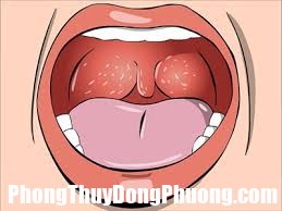 ungvomhong.jpg1  Ý nghĩa việc mơ thấy cổ họng của bạn là gì?