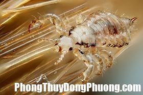 Male human head louse Bật mí giấc mơ khi thấy con chấy và con số may mắn nên đánh