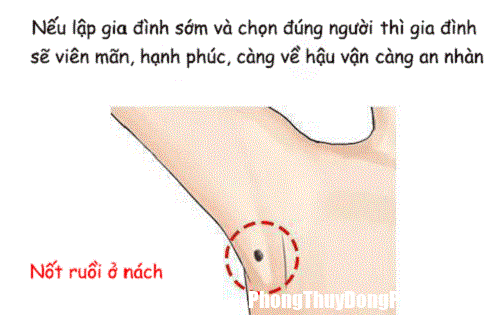 Xem boi not ruoi tren co the Nốt ruồi ở vị trí không bình thường cho thấy chủ nhân không phải người tầm thường