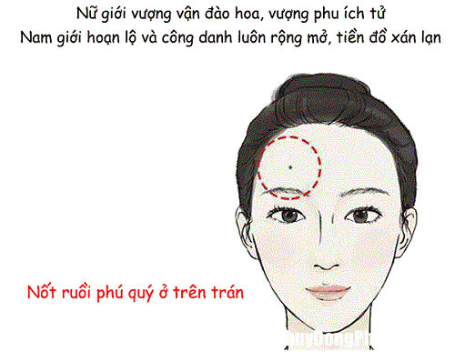 not ruoi o tren tran duoc coi la quy tuong Nốt ruồi ở vị trí không bình thường cho thấy chủ nhân không phải người tầm thường