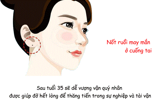 vi tri not ruoi o cuong tai Nốt ruồi ở vị trí không bình thường cho thấy chủ nhân không phải người tầm thường